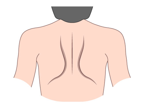 scapular squeeze demo